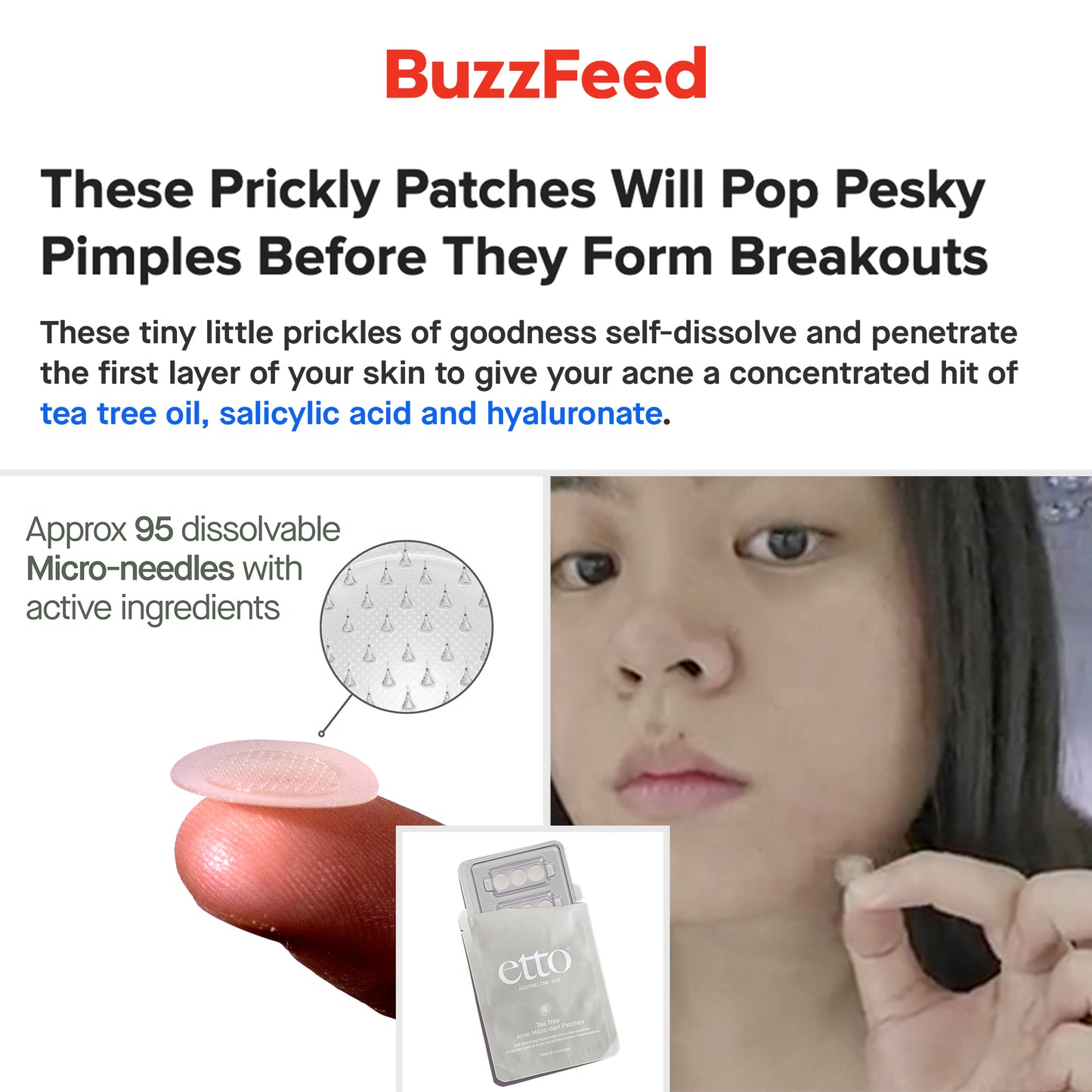Acne Micro-dart Patches, with Terpinen-4-ol, Hyaluronate & Salicylic acid