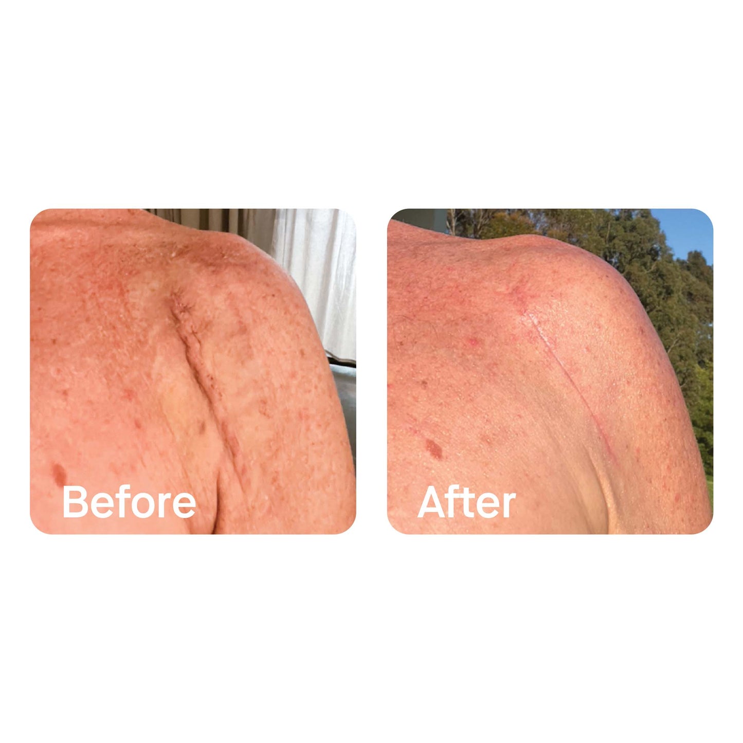 The Skin Balm, Repair, Soothe & Hydrate with Hemp oil, Tea Tree & Chamomile