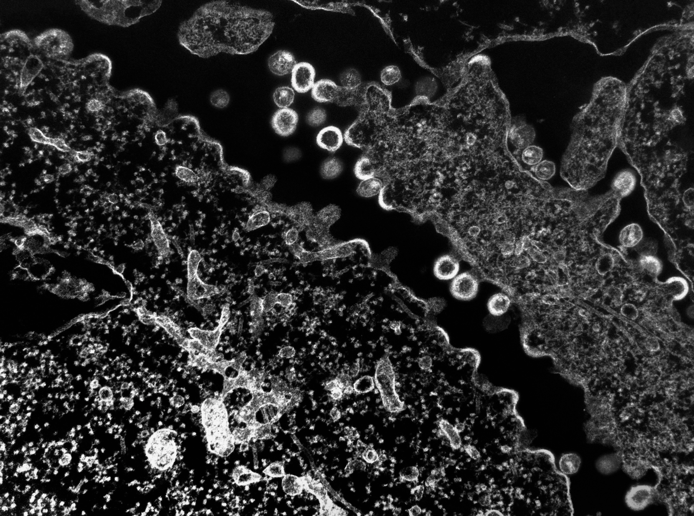 Could Plants Compounds Like Terpinen-4-ol Help Solve Our Antibiotic Problem?