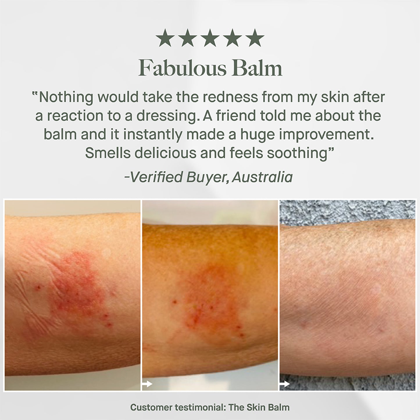 The Skin Balm